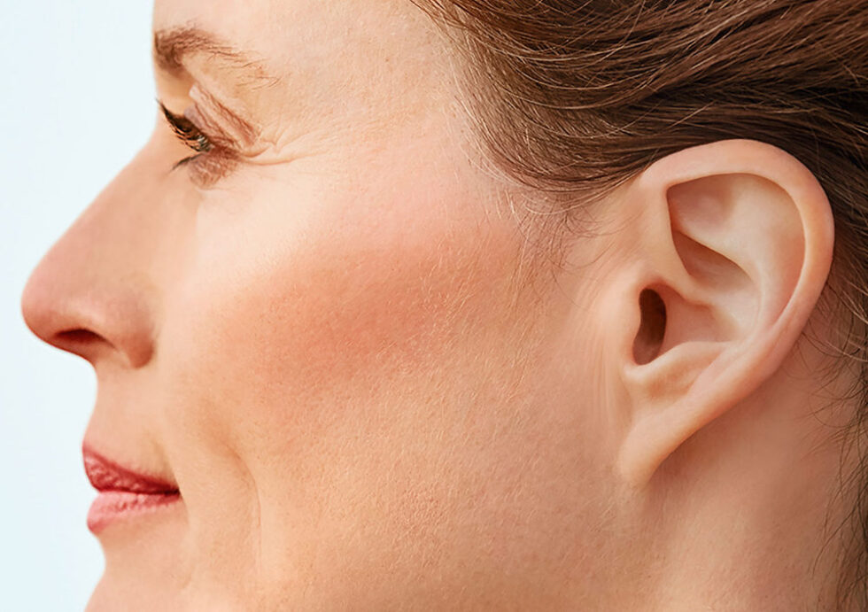 Lyric Invisible Hearing Aid Geelong Victorian Hearing