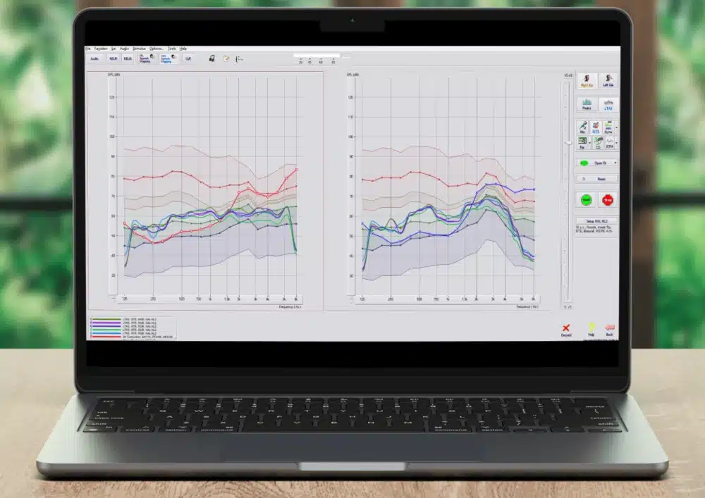 Hearing Aid Verification charts on screen